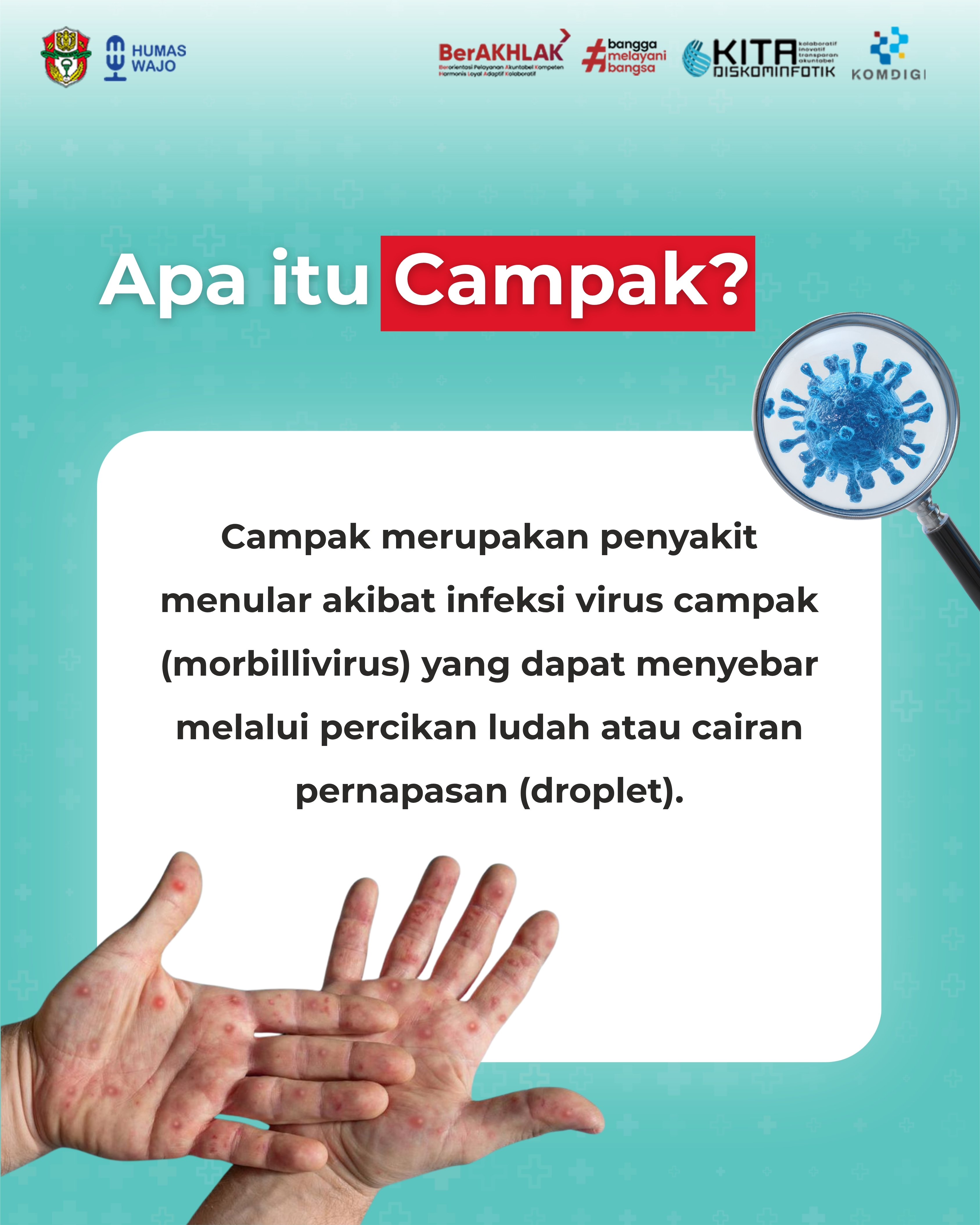 Waspada Campak 2